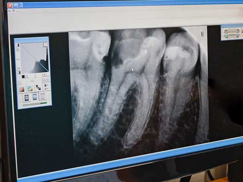 xray-WEB